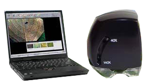 The Turf-Tec IPM Scope combines advanced digital optics and LED lighting in a computerized microscope that fits in the palm of your hand. 40 - 140X magnification lets you zoom in on the fine details of insects and plant disease symptoms. 